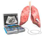 Case G: Urgent Care Referral Using Lung Ultrasound Imaging of Lungs